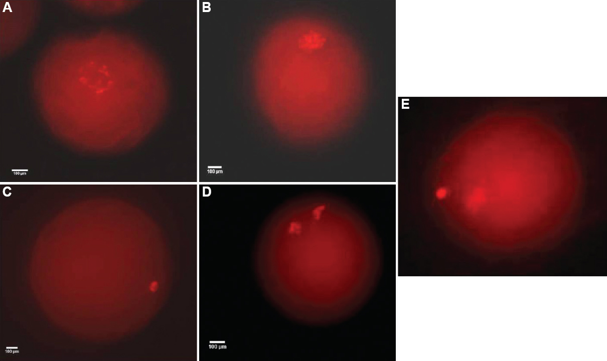 Different nuclear stages observed after ethidium bromide (EtBr) staining of pre-matured and matured denuded oocyte: (A) germinal vesicle (GV); (B) germinal vesicle breakdown (GVBD); (C) metaphase I (MI); (D) ana-telophase (AT); (E) metaphase II (MII) (×400).